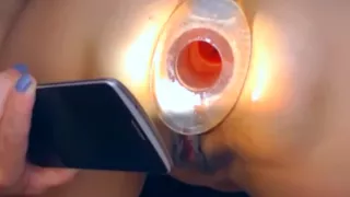 Look At My Destroyed Ass Inside Illuminated With A Lantern