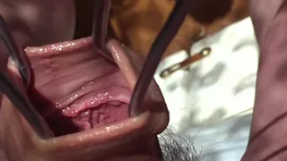 High definition foreskin in sunlight