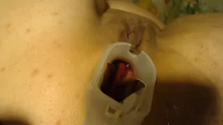 Anal Speculum And Show Inside My Ass Part 2