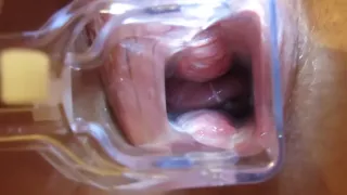 play with gynecological mirror and masturbate)