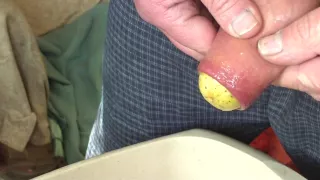 Foreskin bulge from large potato and pissing