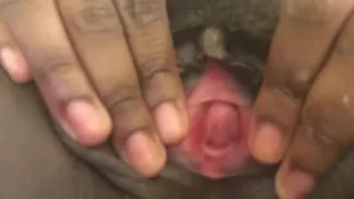 Upclose and Personal with a Fat Pus