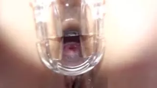 Kinky pregnant babe pussy gaped with speculum in close-up