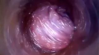 Flirty Czech Chick Spreads Her Narrowed Vagina To The Peculi