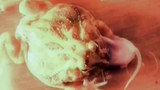 Il Bivio Dell'essere