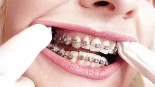 ASMR video: hot BRACES and double layer of medical nurse nitrile gloves (Arya Grander)