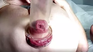 Fist Time pumped Prolapse with Penispump - Just a little off the mark :-)  - analplay