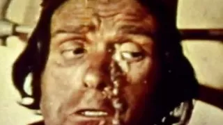 NASTY NURSES - (Restyling Movie in Full HD Version)