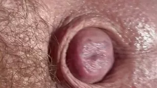 Foreskin jacking off micropenis