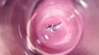 Inside Mia's vagina, internal camera in teen pussy