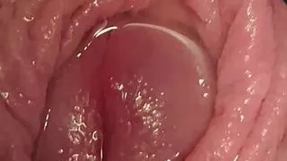 Foreskin close up with alot of piss