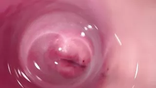 Camera deep inside Mia's creamy pussy, teen Cervix close up