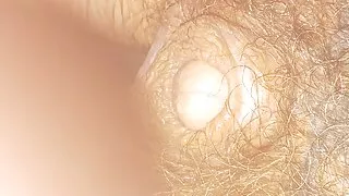 30 Fr catheter in tiny bi mtf cock