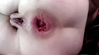 Fisting my gaping asshole et pussyhole and prolapse