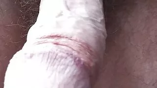 Will ripped his shorts by Hairyartist Will