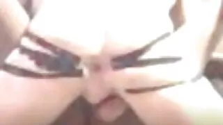 Cock Restrained And Asshole Opened Wide With Tape While Cumming