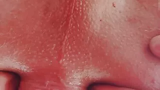 Close Up of my destroyed asshole.