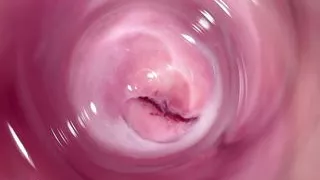 Camera deep inside Mia's teen creamy pussy, Internal camera