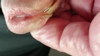 A couple of close ups