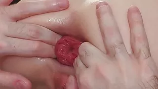 We're back! Anal Fisting: The CUMBACK