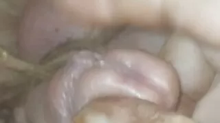 Split head and balls