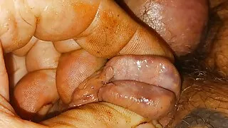 Inflated Badder with Pissing and Needle in Cock Gland Inflation Pain  That Is Pleasure Bisexual Male.