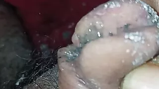 More burning on penis head with lit cigarette