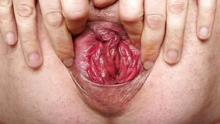 Ballspiele und offenes Loch