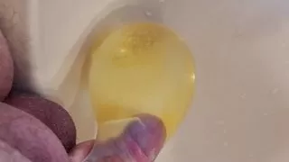Peeing into a condom - try to let it burst