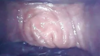 Lizzy Yum 2023 speculum camera put camera in vagina canal post op pussy shemale masturbate
