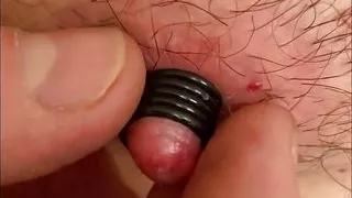 Nipple stretching with orings