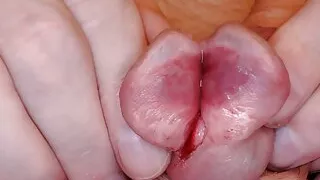 Jacking off and Gaping my split glans