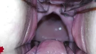 The mistress' cunt is opened with a hole expander so that you can study her cervix.