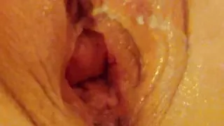 My greedy pussy fisted hardcore pussy stretch and gape pussy punching fist white wife big pussy hot wife fist fucked