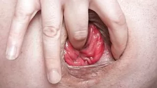 Total offen und gedehnt