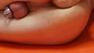 Total anal destruction of young boy