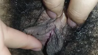 full lips (labios carnosos)