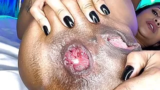 flexi skinny milf prolapse her asshole