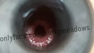 Hollow plug training close up