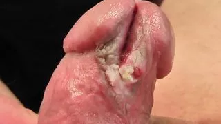 Extreme Close Up of my Split Cock