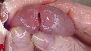 Super close-up of the glans. Urethral games with the dilator.