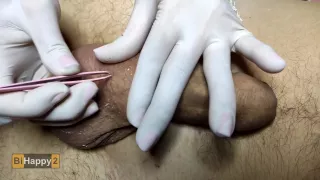 She Painted Smiley On Eggs With Hot Wax Depilation