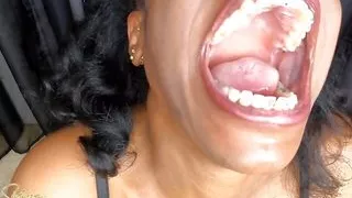 I'm ready for my mouth exam, custom