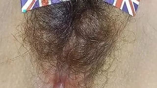 England hairy