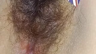 England Hairy