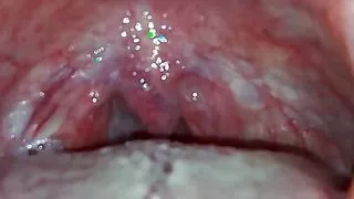 Shrinking Daniel by Hairyartist