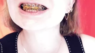 Asmr Eating Jelly Bears With Braces by Arya Grander