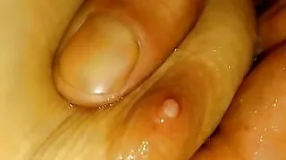 Foric sleev nip blow slept