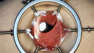 CLOSE Up ft David Anderson