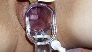 Dilated pussy